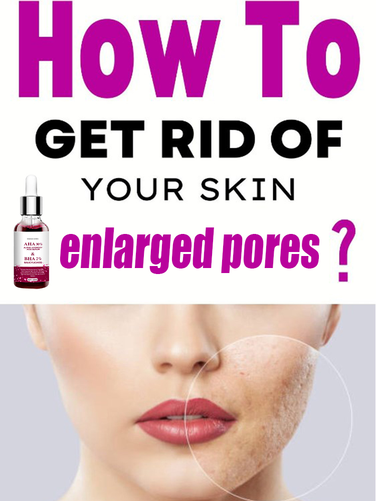 Salicylic Acid Blackhead Remover - 모공 축소 세럼 살리실산 과일산 함유