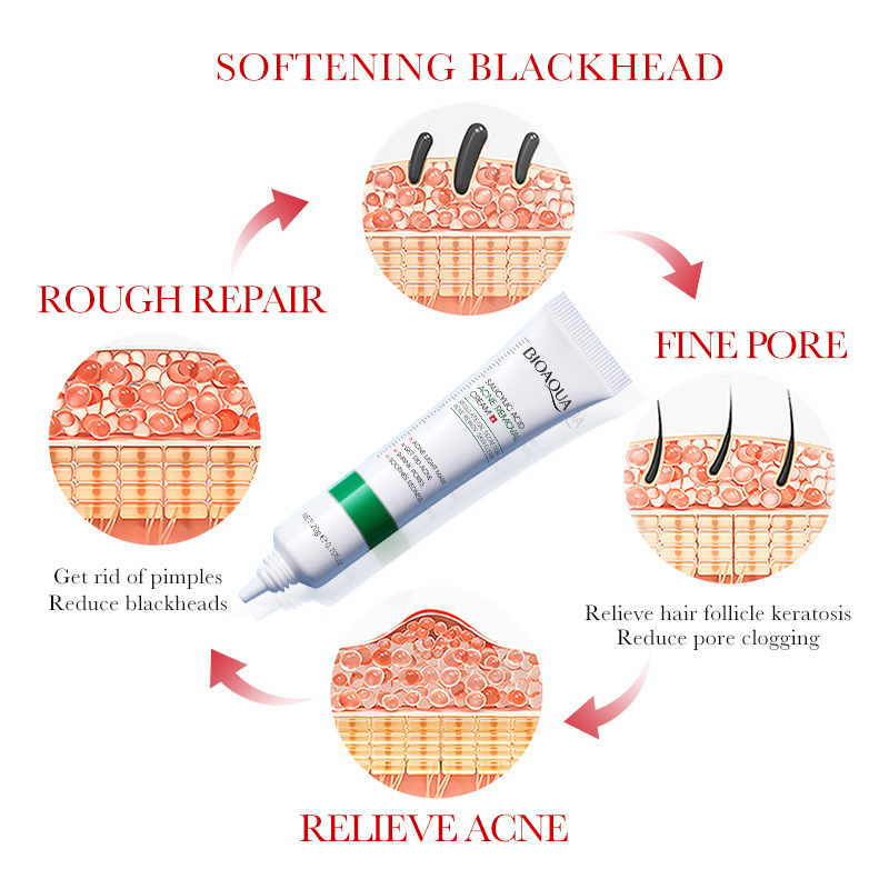 1/2/3pcs BIOAQUA 살리실산 페이스 크림 여 - Salicylic Acid Blackhead Remover 리뷰 및 가격