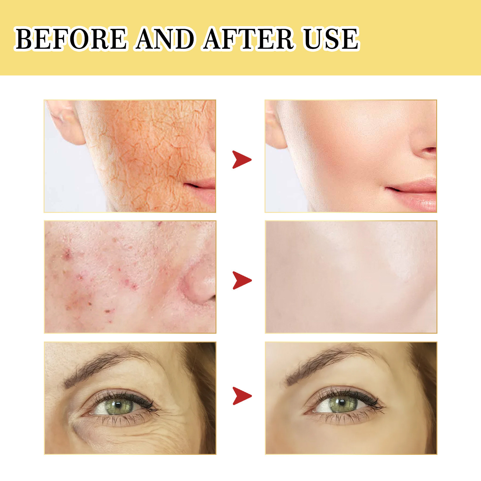 얼굴 민감성 달팽이 무신 96% 리페어 에센스 - Snail Mucin 96 Repair Essence 리뷰 및 가격