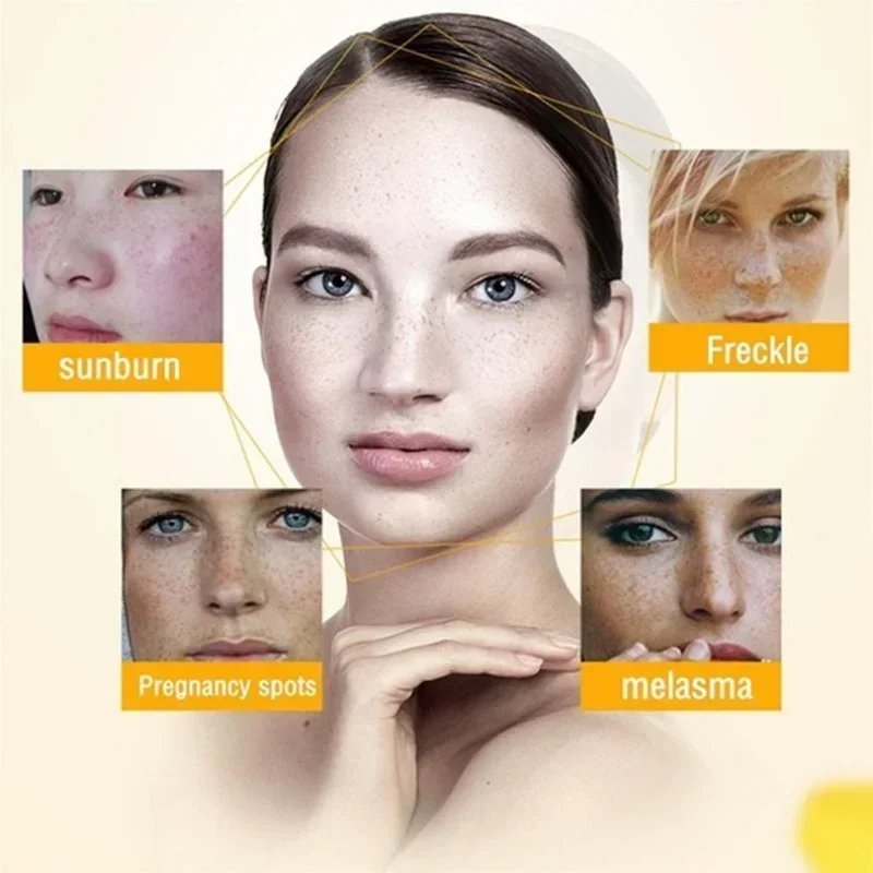 주름 제거 크림 레티놀 페이스 안티 에이징 퍼밍 리프팅 - Retinol Anti Wrinkle Cream 리뷰 및 가격
