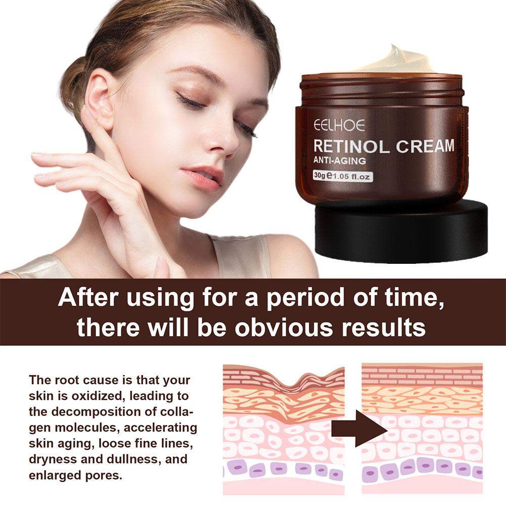 EELHOE 1/2/3/5PCS(3개 구매 시 2개 무 - Retinol Anti Wrinkle Cream 리뷰 및 가격