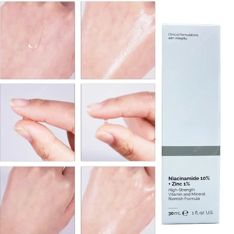 나이아신아마이드 마그네슘 미백 에센스, 모공 축소, 고 - Niacinamide Pore Shrinking Essence 리뷰 및 가격