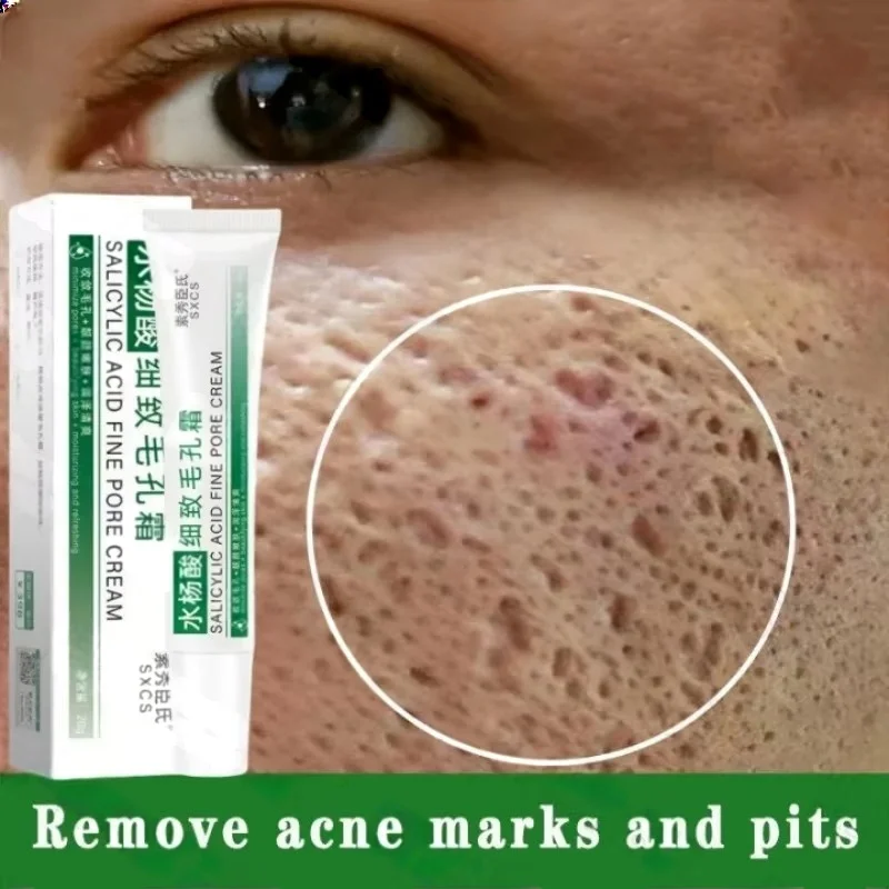 살리실산 모공 클리어링 크림 모공 축소 블랙헤드 제거  - Salicylic Acid Blackhead Remover 리뷰 및 가격