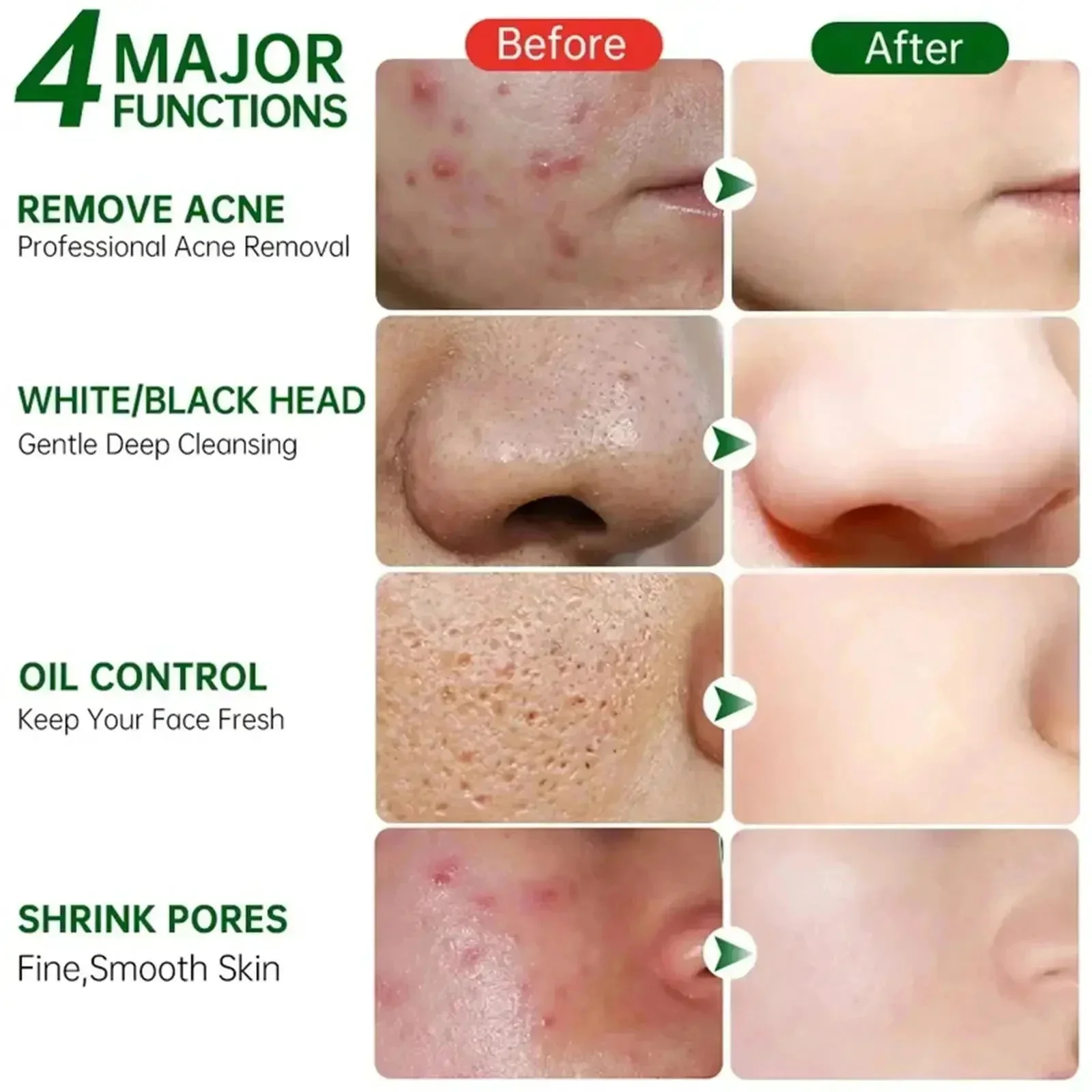 살리실산 모공 클리어링 크림 모공 축소 블랙헤드 제거  - Salicylic Acid Blackhead Remover 리뷰 및 가격