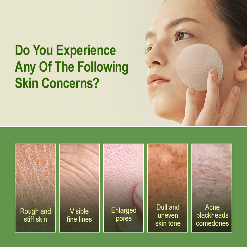 살리실산 엑스 폴리 에이 팅 패드 오일 컨트롤 블랙 헤 - Salicylic Acid Blackhead Remover 리뷰 및 가격
