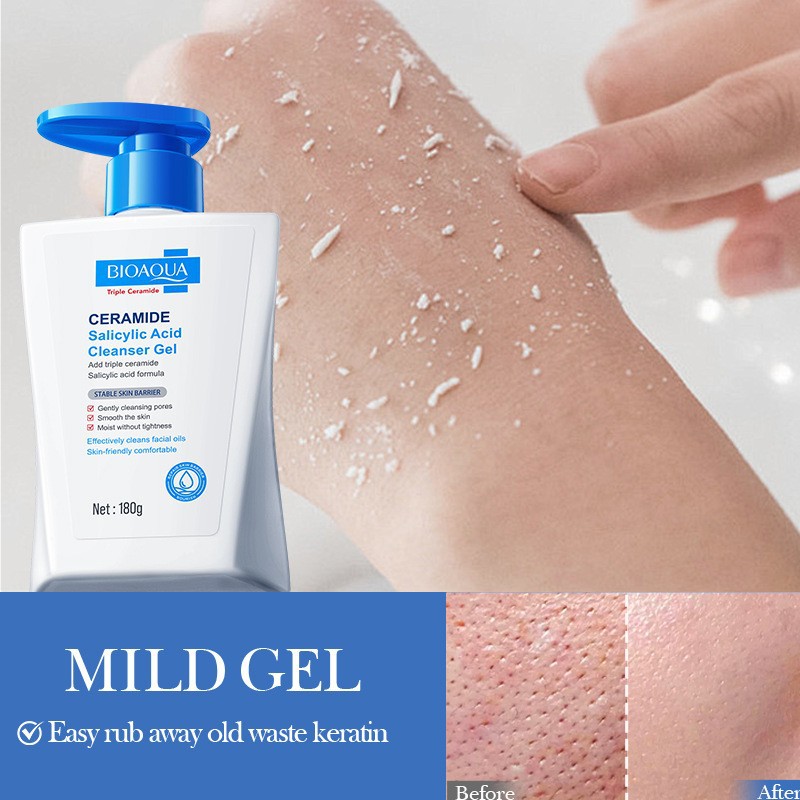 세라마이드 살리실산 클렌징 젤 딥 클렌징 및 보습 블랙 - Salicylic Acid Blackhead Remover 리뷰 및 가격