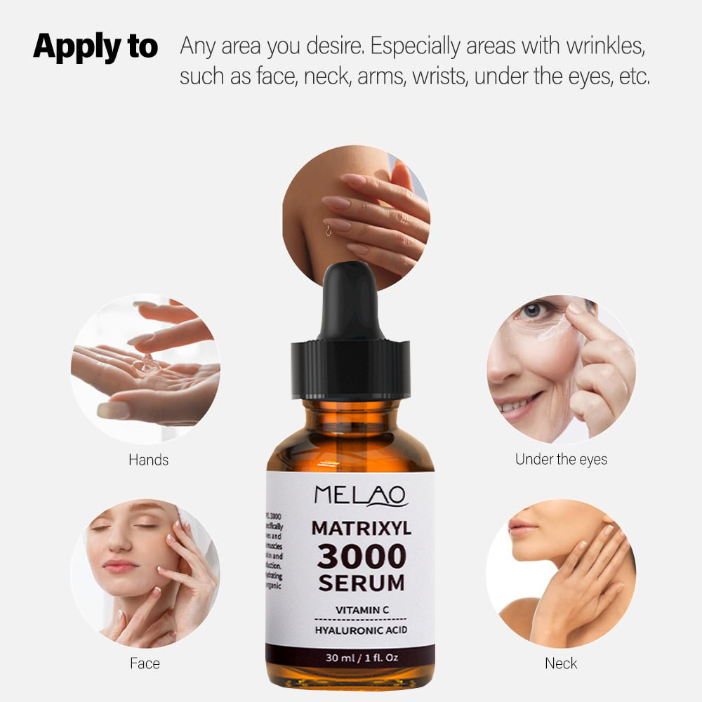 매트릭실 3000 세럼 히알루론산 부스팅, 안티에이징  - Hyaluronic Acid Facial Serum 리뷰 및 가격