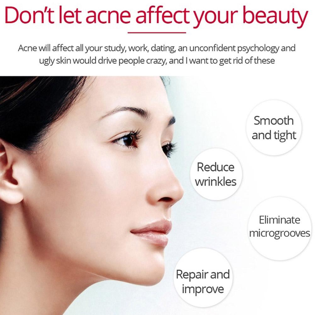 레티놀 리프팅 퍼밍 크림, 주름 제거, 안티 에이징,  - Retinol Anti Wrinkle Cream 리뷰 및 가격