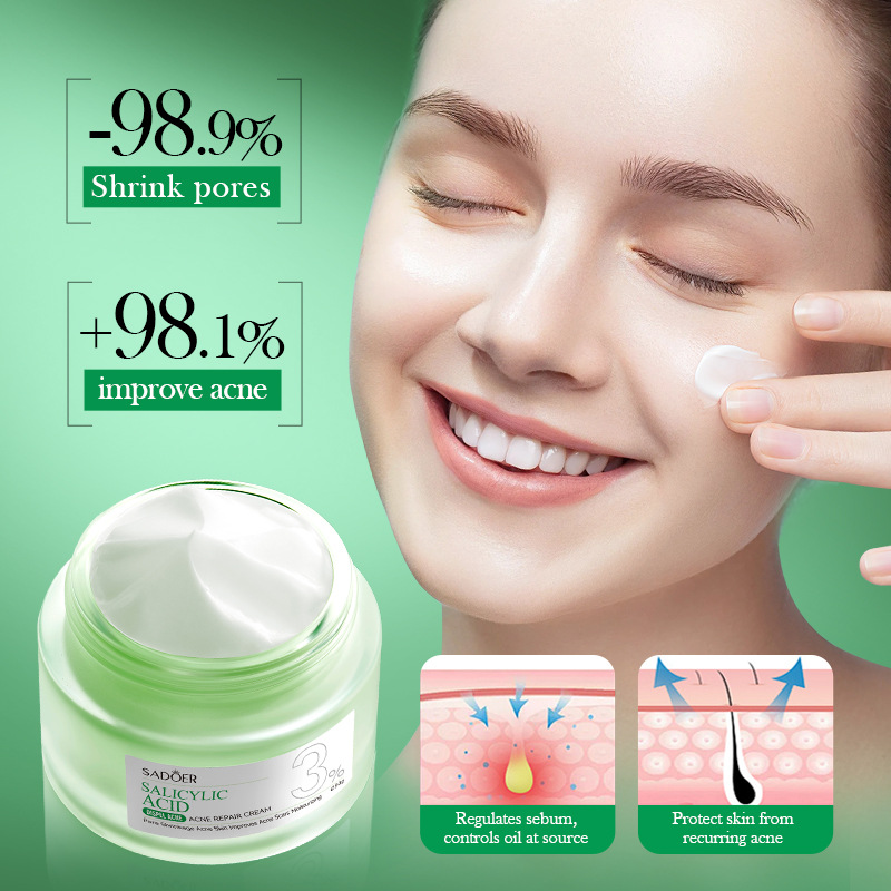 살리실산 여드름 치료 크림, 여드름 자국 개선, 블랙헤 - Salicylic Acid Blackhead Remover 리뷰 및 가격