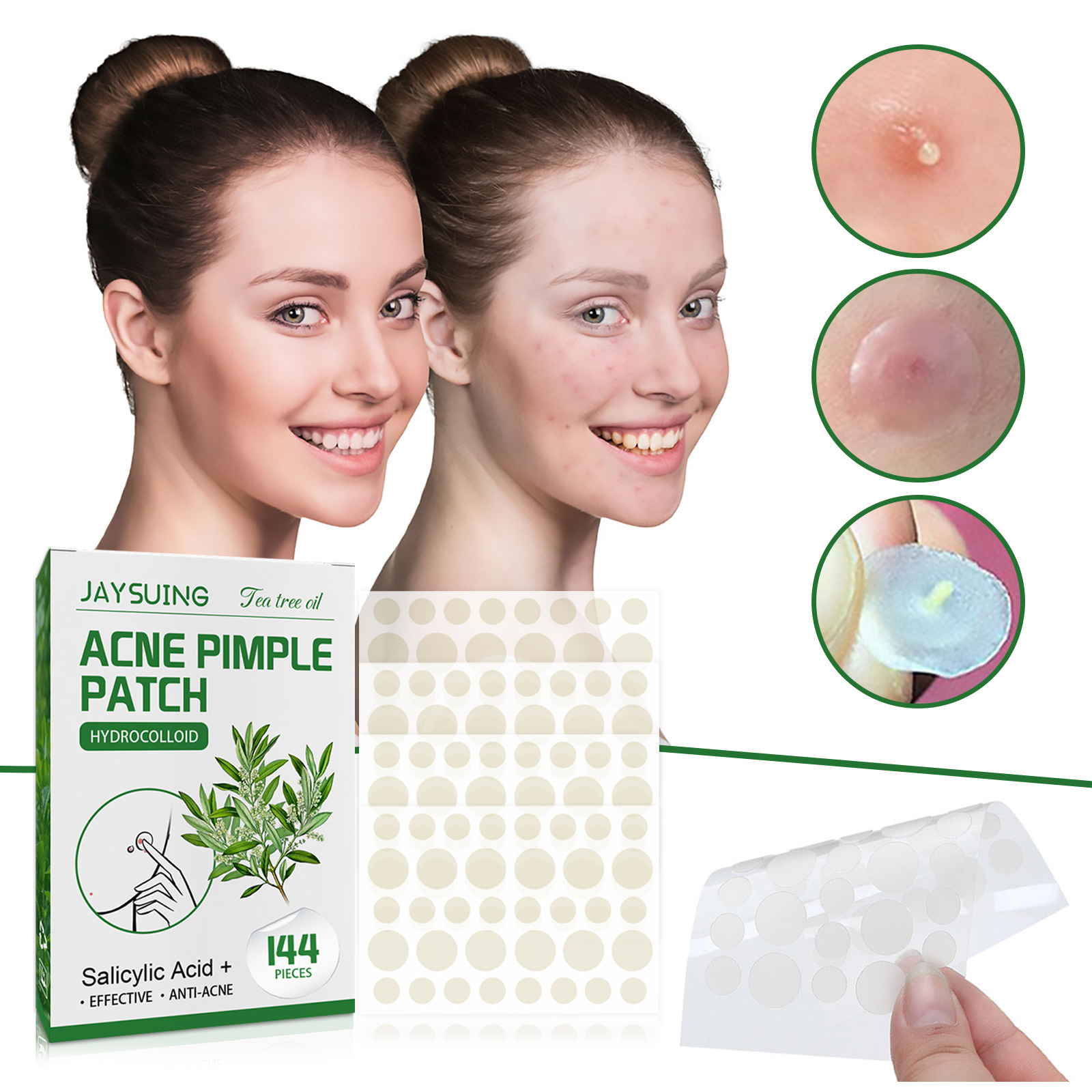 하이드로콜로이드 여드름 패치 - 점액 및 유분 흡수,  - Hydrocolloid Pimple Patch 리뷰 및 가격