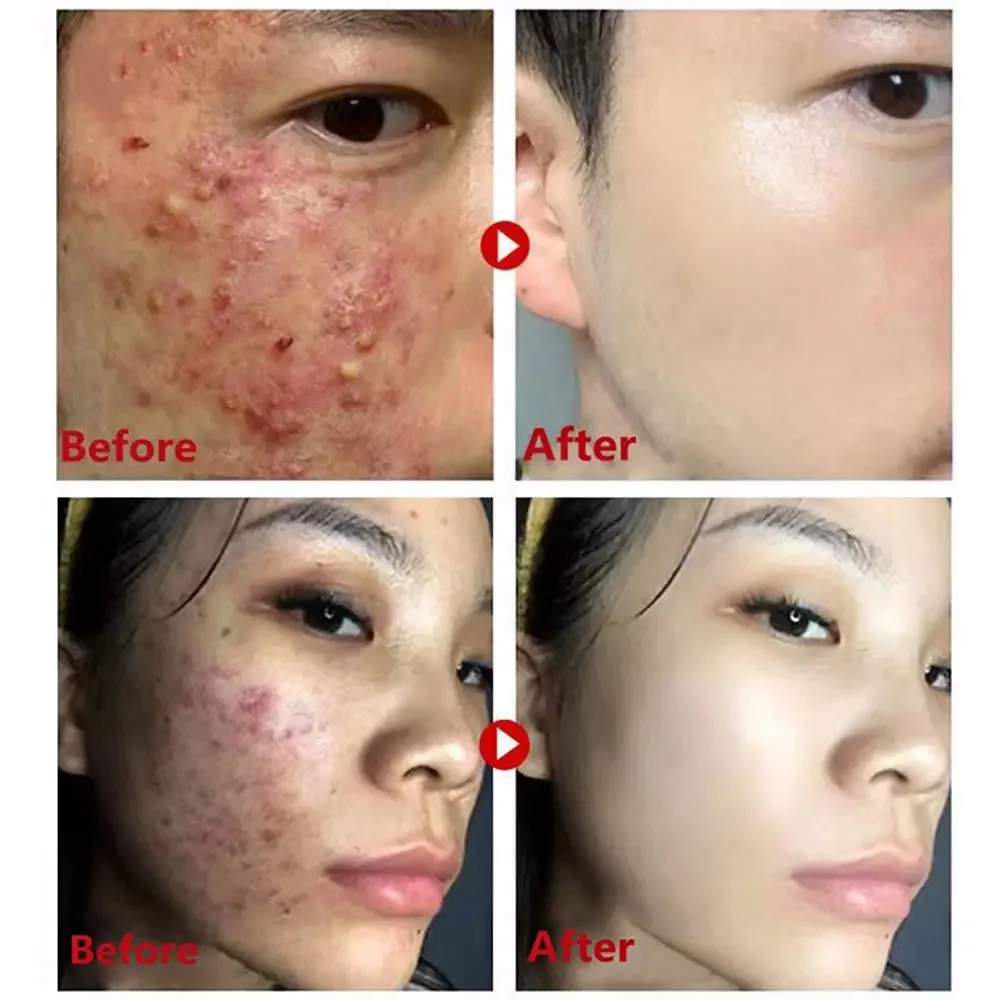 녹차 마스크 스틱 블랙헤드 제거 딥 클렌징 클렌징, 클 - Green Tea Cleansing Clay Mask 리뷰 및 가격