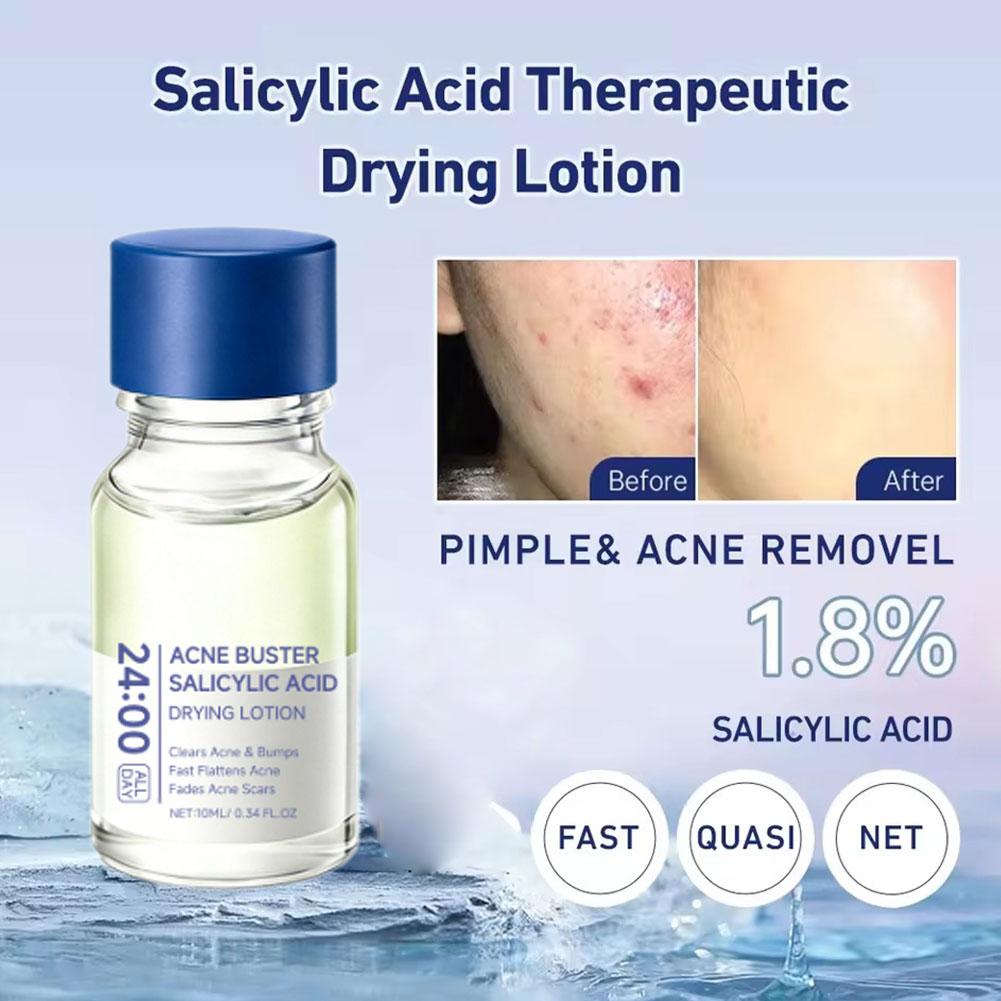 살리실산 여드름 제거제 블랙헤드 오일 컨트롤 모공을 부 - Salicylic Acid Blackhead Remover 리뷰 및 가격