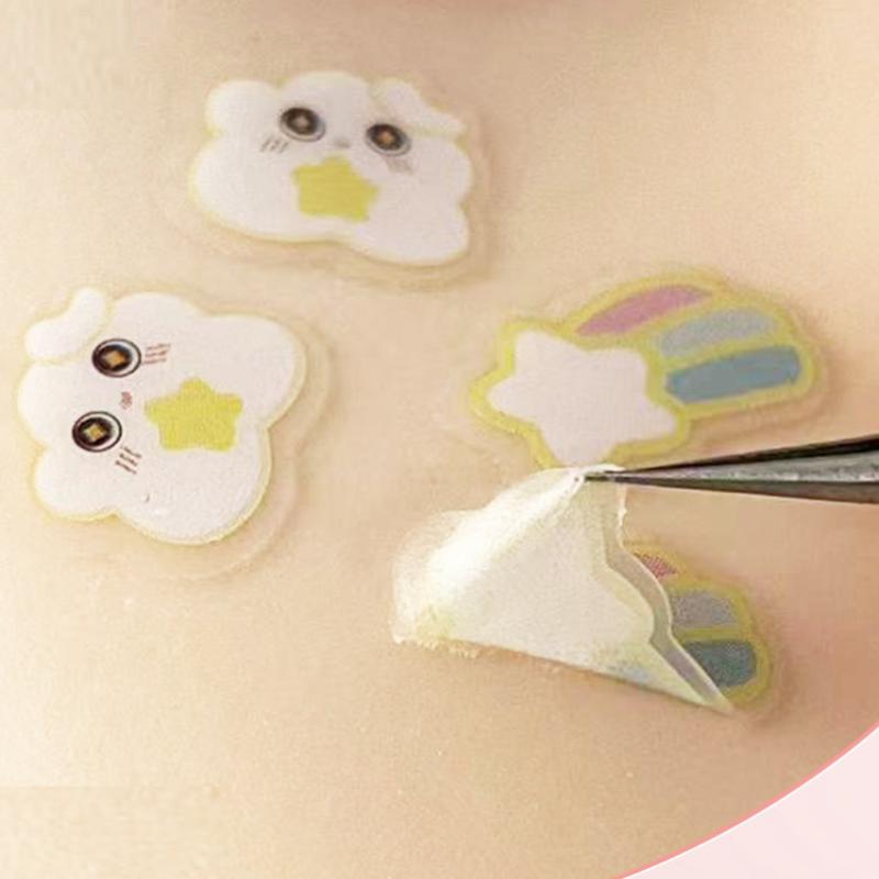 20pcs 제거 여드름 패치 스킨 케어 트리트먼트 스티 - Skincare 리뷰 및 가격
